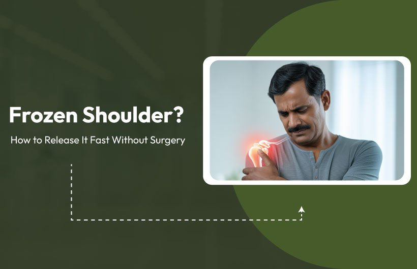Frozen Shoulder? How to Release It Fast Without Surgery