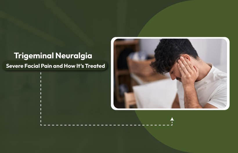 Trigeminal Neuralgia: Severe Facial Pain and How It’s Treated