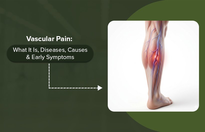 Vascular Pain: What It Is, Diseases, Causes & Early Symptoms