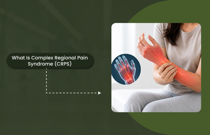 What Is Complex Regional Pain Syndrome (CRPS) ?