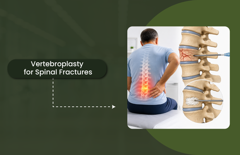Vertebroplasty for Spinal Fractures: Benefits, Risks & Recovery