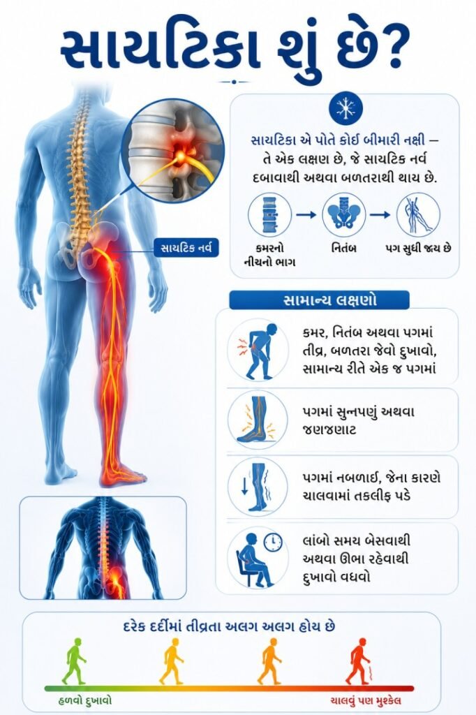 સાયટિકા (રાંઝણ) દુખાવો સારવાર અમદાવાદ
