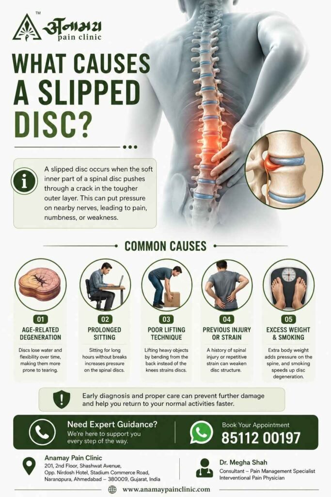 What Causes a Slipped Disc
