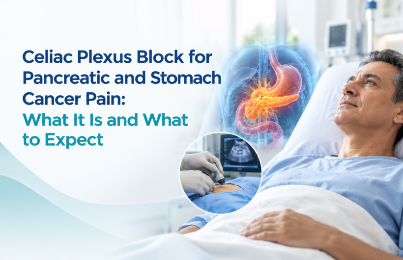 Celiac Plexus Block for Pancreatic and Stomach Cancer Pain: A Guide for Patients